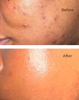 Skin texture before and after using Juka's Clean Beauty Face Moisturizer