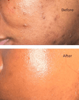 Skin texture before and after using Juka's Clean Beauty Face Moisturizer