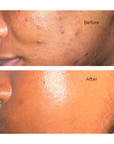 Natural Glow Moisturizer - For Oily Skin