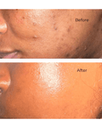 Natural Glow Kit - Oily Skin