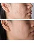 Facial Mask