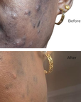 Juka's Facial Mask for Youthful Radiance before and after