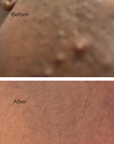 Juka's Facial Mask for Youthful Radiance before and after