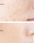 Face skin before and after using Juka's Clean Beauty moisturizer