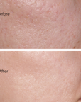 Juka's Daily Cleanser for Clean Skin before and after
