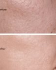Juka's Daily Cleanser for Clean Skin before and after