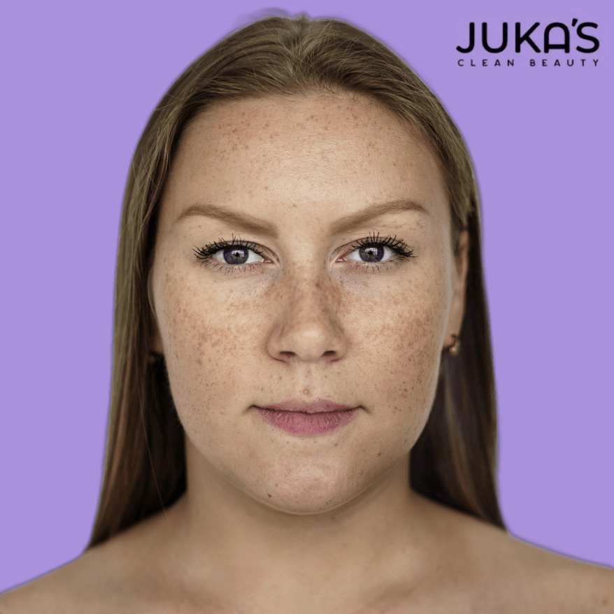 Close-up of a woman highlighting skin, promotes Hyperpigmentation Moisturizer to Fade Dark Spots.
