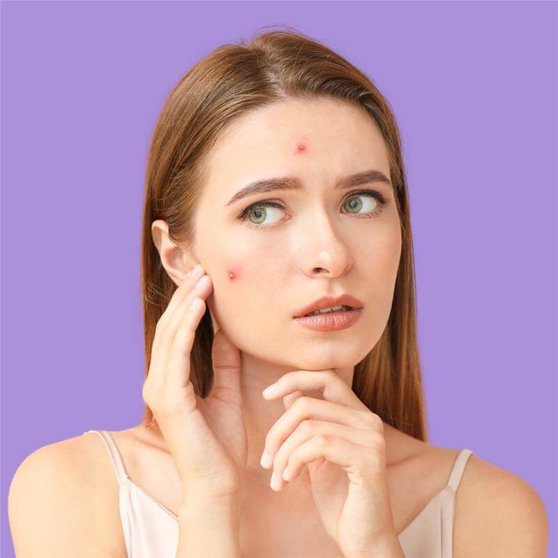 Acnes gentle cleanser acne skin kit for oily acne prone skin