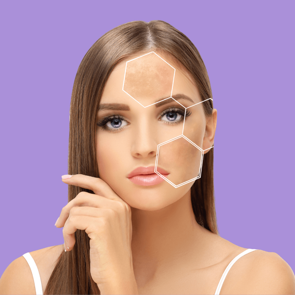 Kojic acid skincare kit for dark spots and hyperpigmentation