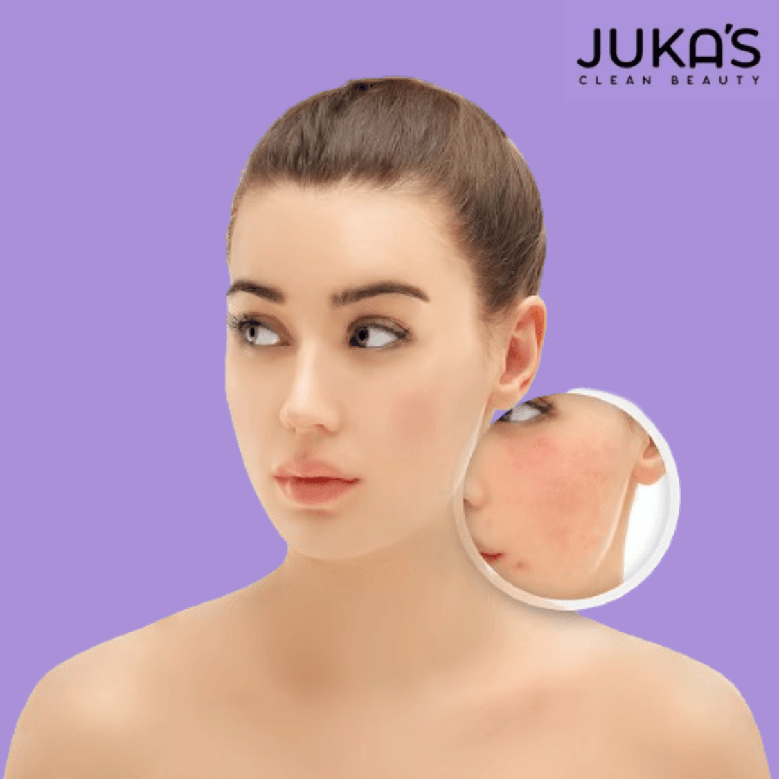 Buy Juka’s Clean Beauty Anti-Acne Kit