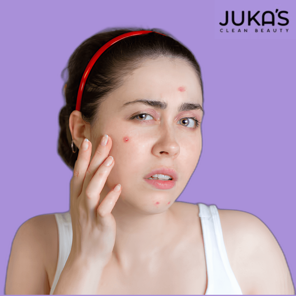 Buy Juka's Clean Beauty Anti-Acne Facial Kit