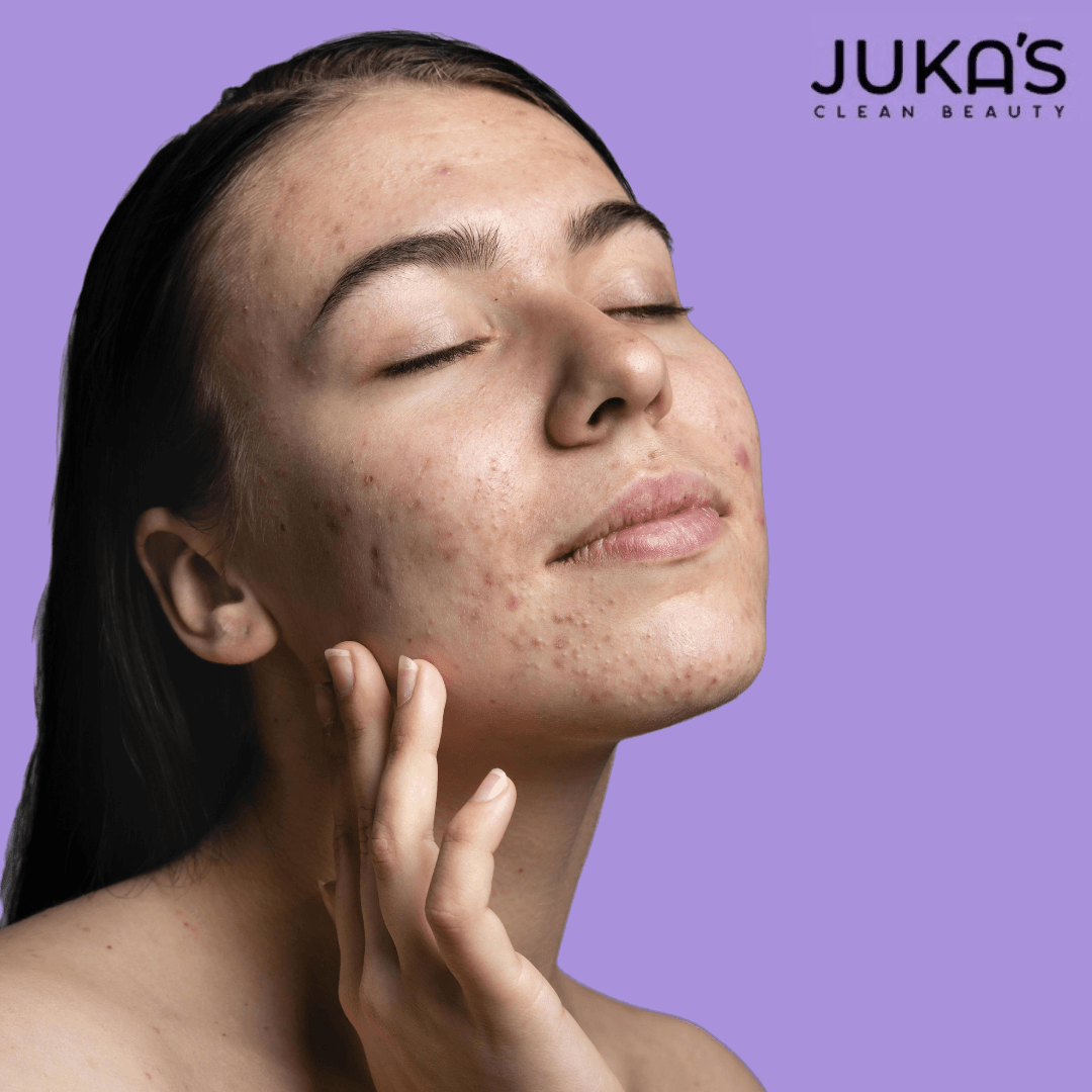 Buy Juka's Clean Beauty Moisturizer to remove dark spot on face 
