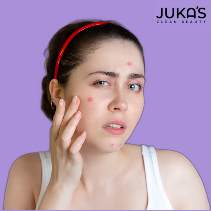 Buy Juka's Clean Beauty Anti-Acne Facial Kit