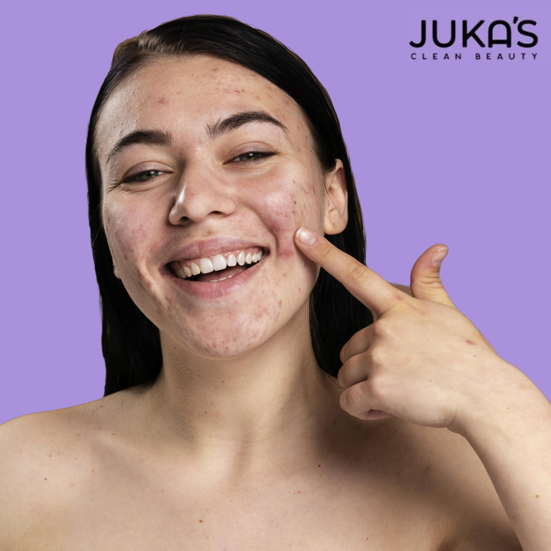 Buy Best Face Cream to Get Rid of Dark Spots