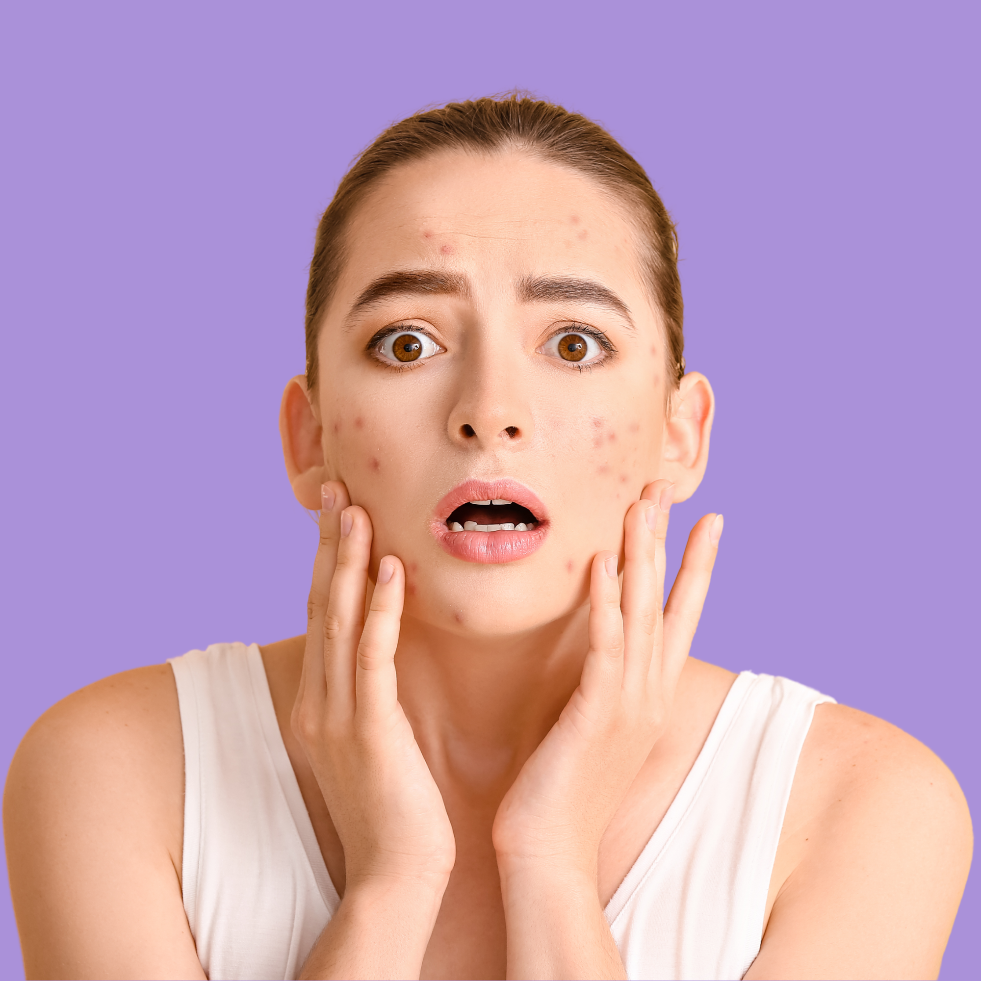 acne treatment kit for oily acne prone skin clear skin