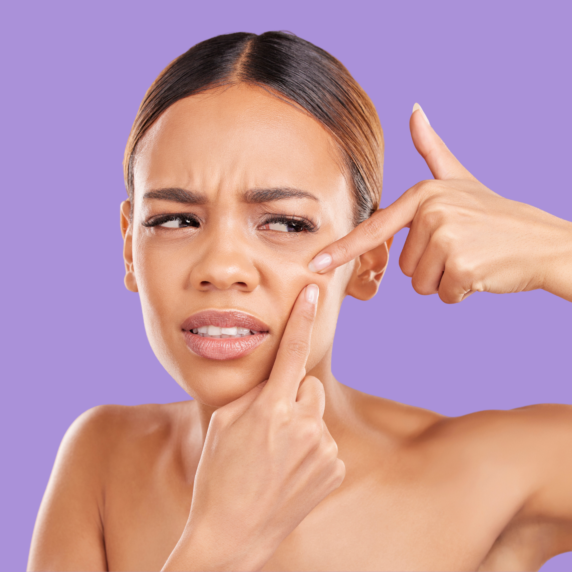 Acne treatment kit for clear skin with natural skincare products