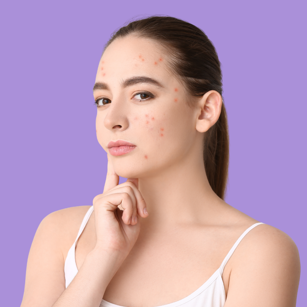 acnes gentle cleanser for oily and acne prone skin routine