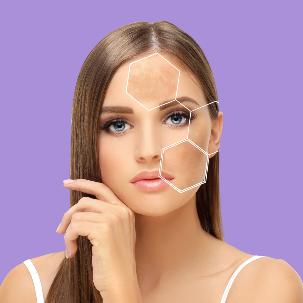 Kojic acid skincare kit for dark spots and hyperpigmentation