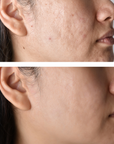Juka's Facial Mask for Youthful Radiance: Skin Results