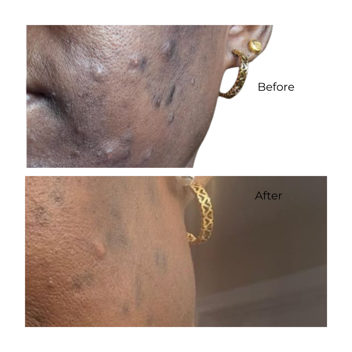 Facial Mask