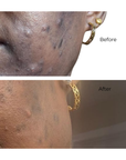 Facial Mask