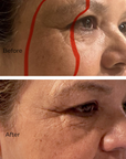 Juka's HyperGlow Face Moisturizer for Dark Spots before and after
