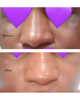 Hyper Glow Moisturizer - For Dark Spots