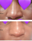 Juka's HyperGlow Face Moisturizer for Dark Spots skin results