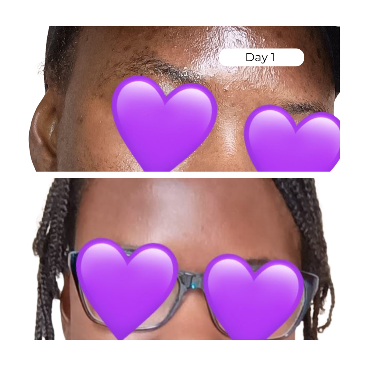 Hyper Glow Moisturizer - For Dark Spots
