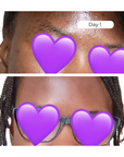 Hyper Glow Moisturizer - For Dark Spots