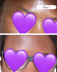 Juka's HyperGlow Face Moisturizer for Dark Spots skin results