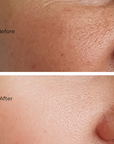 Juka's Extra Glow Face Moisturizer for Normal to Dry Skin before and after